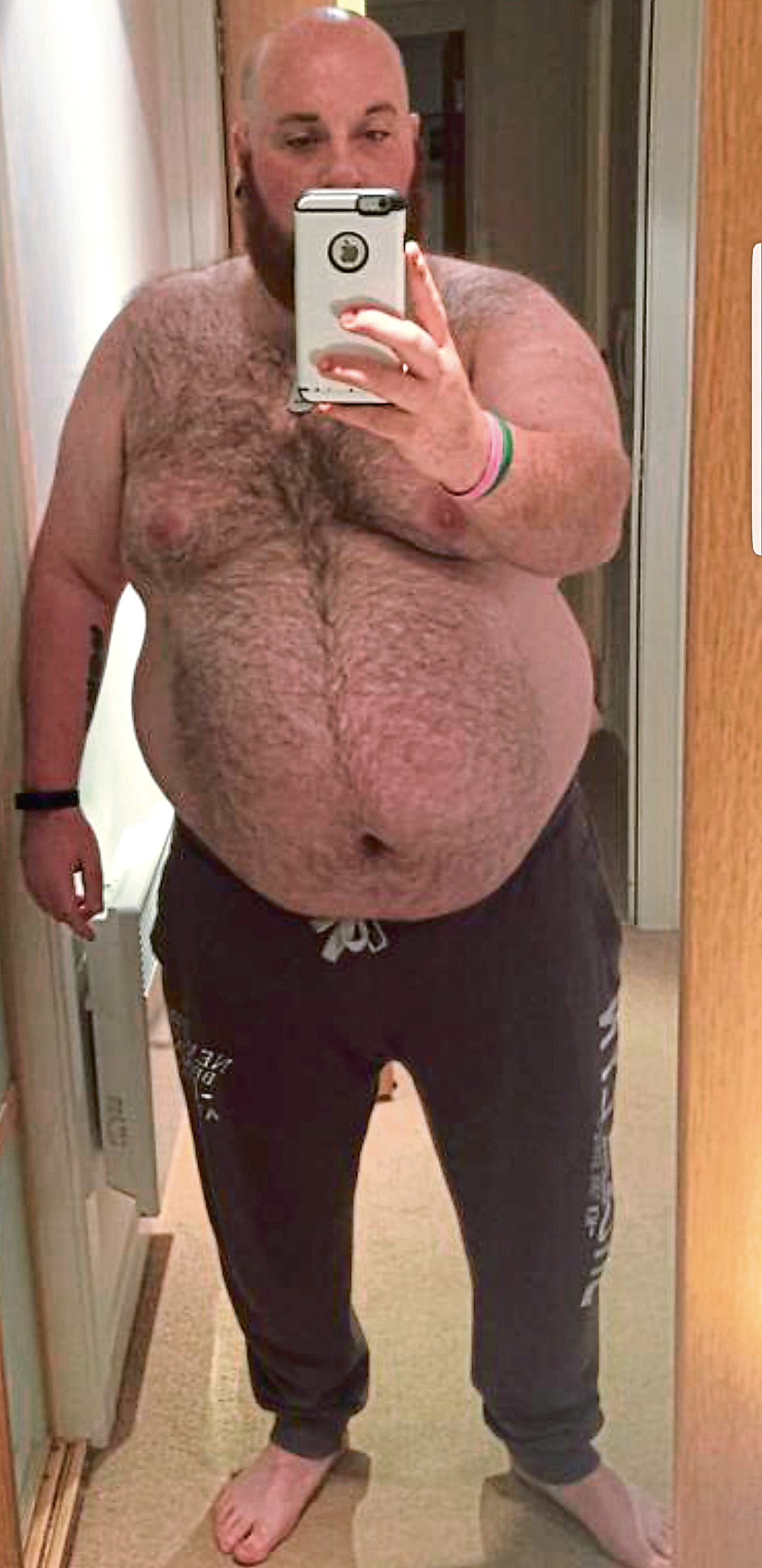 Morbidly Obese Dundee Bus Driver Sheds 12 Stone After Becoming Vegan