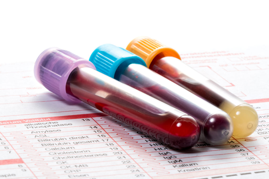 Blood samples are on a laboratory form for Finding out the blood values