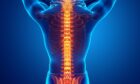 International SOS musculoskeletal disorders