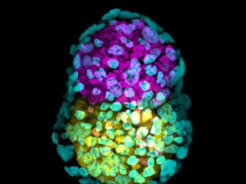 (Craig Brierley/Cambridge University)