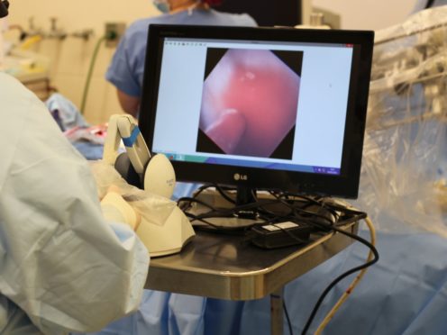 A surgeon oversees the robot catheter as it seeks out a leaky valve in a the heart of a live pig (Fagogenis et al/Science Robotics/PA)
