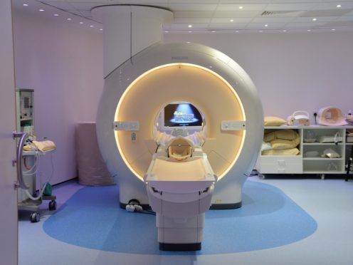 Researchers discovered that MRI scans from when people were first diagnosed contained signs of future progression (Anna Gowthorpe/PA)