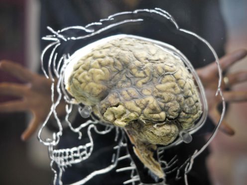 Minute-to-minute brain activity fluctuations ‘impact risk-taking’ (Ben Birchall/PA)