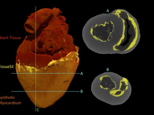 CT scans of the biohybrid heart (Park et al., Sci Robotics)