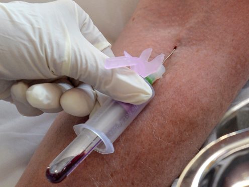 Scientists have developed a blood test that can detect more than 50 types of cancer before any clinical signs or symptom of the disease (Anthony Devlin/PA)