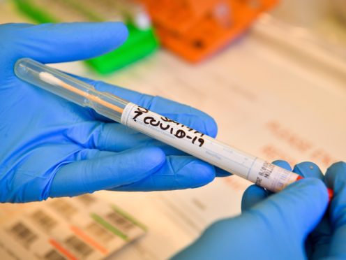 Officials are working on rapidly increasing the number of tests that can be conducted by Public Health England and the NHS in laboratories (Ben Birchall/PA)