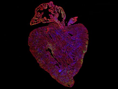 Adult mouse heart after activation of proteins vital for cell replication (Dr Cathy Wilson/ University of Cambridge/PA)