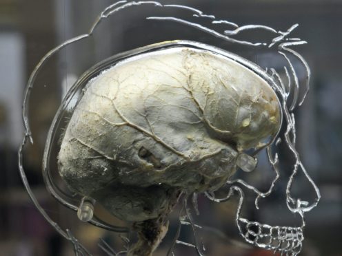A new molecule may be able to restore brain and spinal cord function (Ben Birchall/PA)