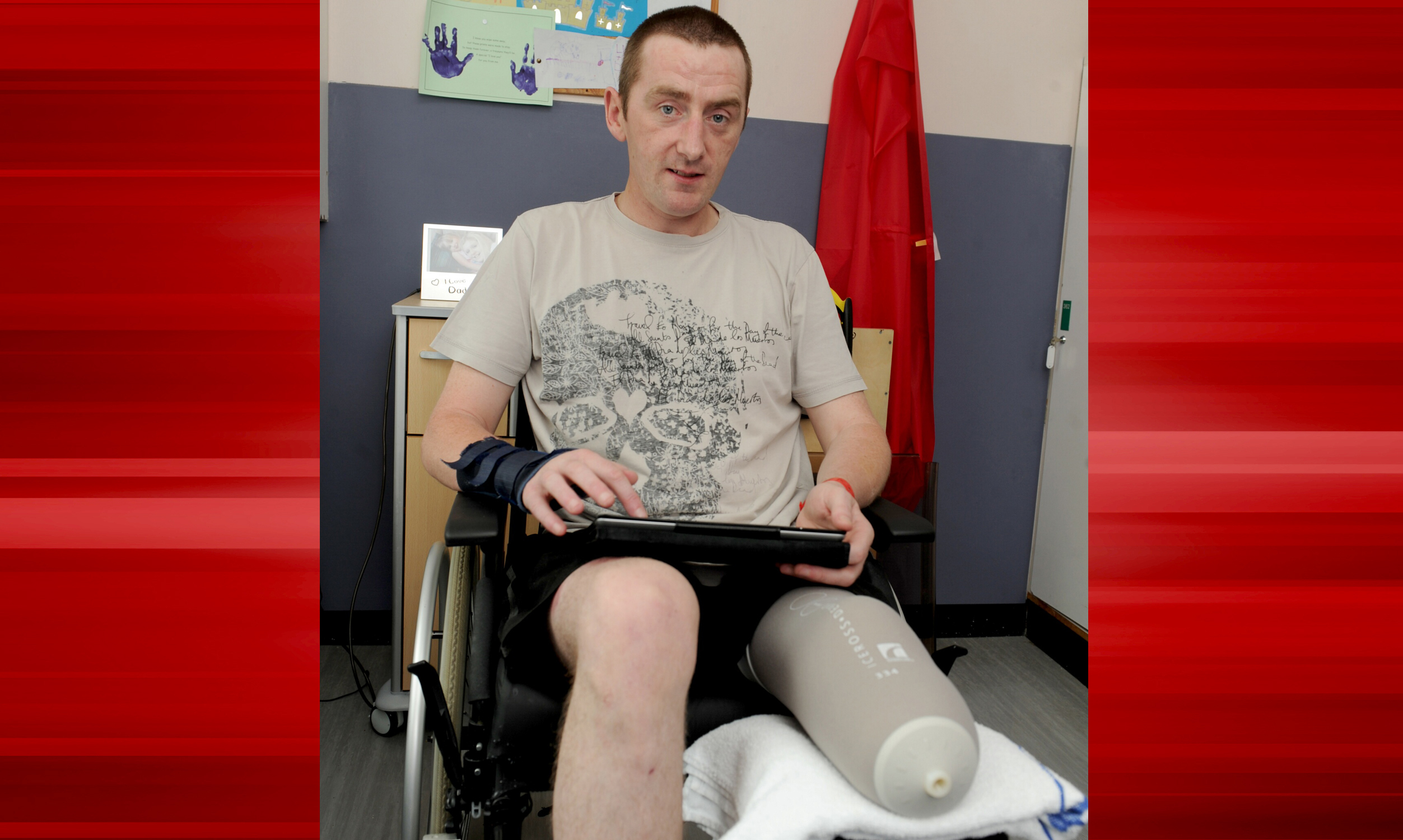 Greig Yorke during his time in Ninewells Hospital