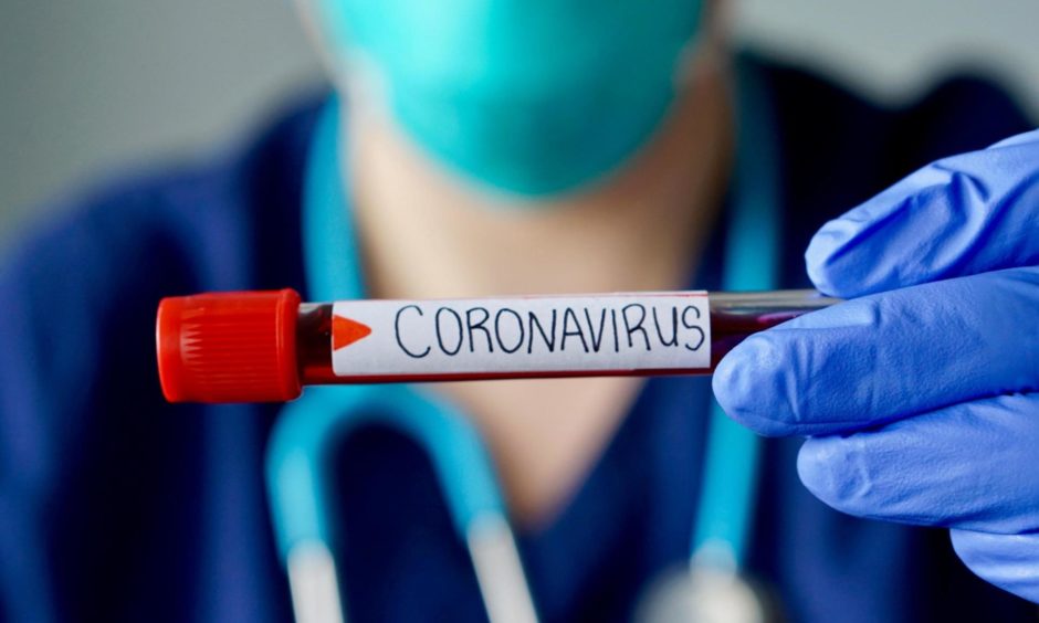 Tayside and Fife record 17 new coronavirus deaths in past 24 hours - Vimarsana News