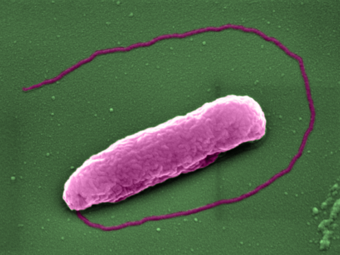 Last-resort antibiotic colistin pops bacteria like balloons, a study suggests (Imperial College London/PA)