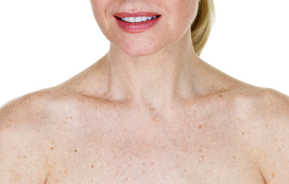 woman with age spots