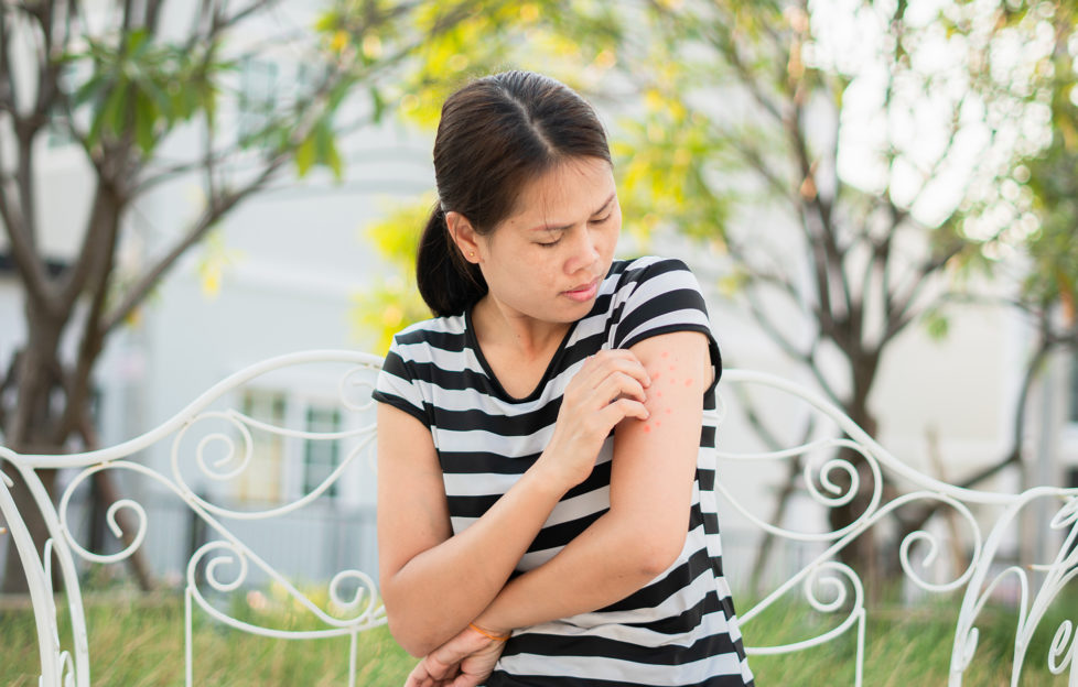 An Asian girl who has been bitten by an insect on his arm and causes a burning sensation in her front garden. Health care and medical concepts;