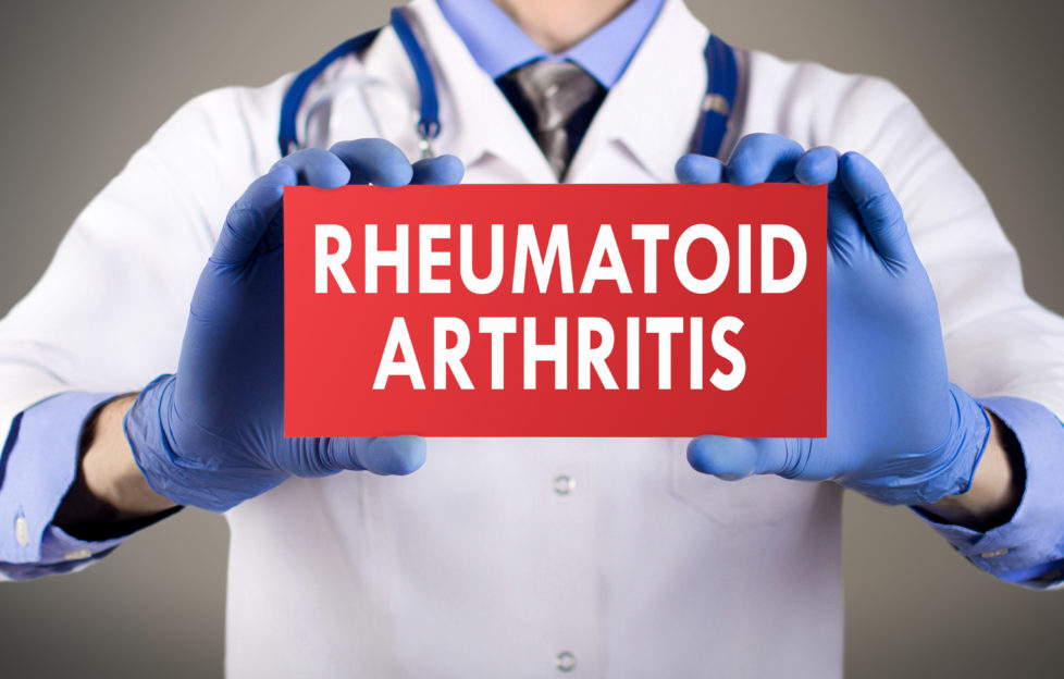 Rheumatoid Arthritis