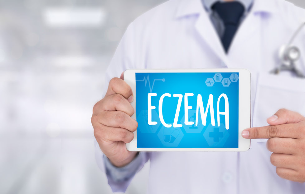 eczema