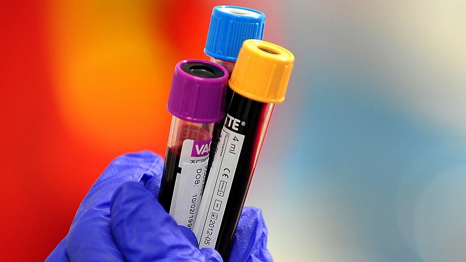 Blood tests required for women using Esmya