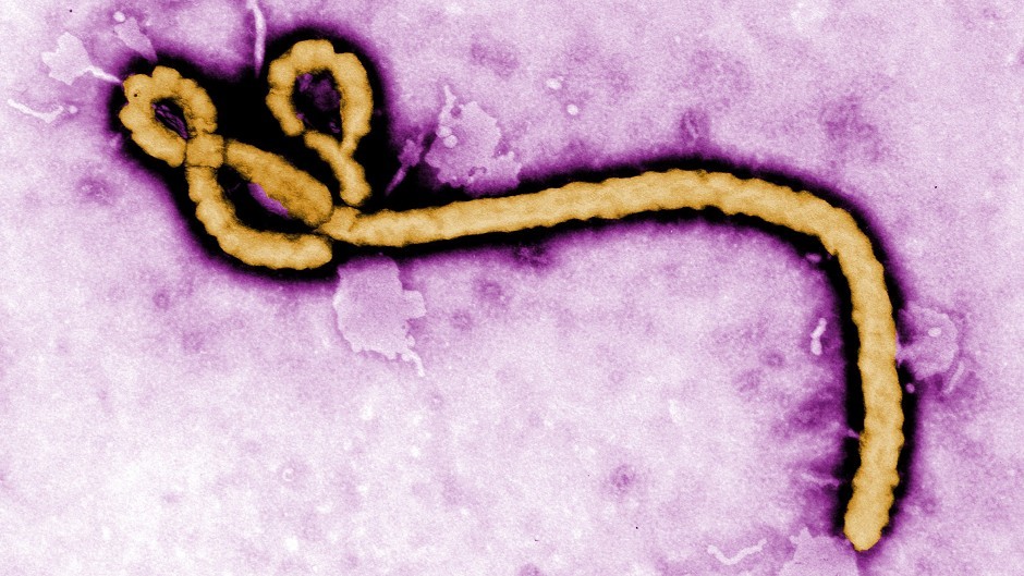 An outbreak of the Ebola virus in West Africa has killed around 53% of those infected