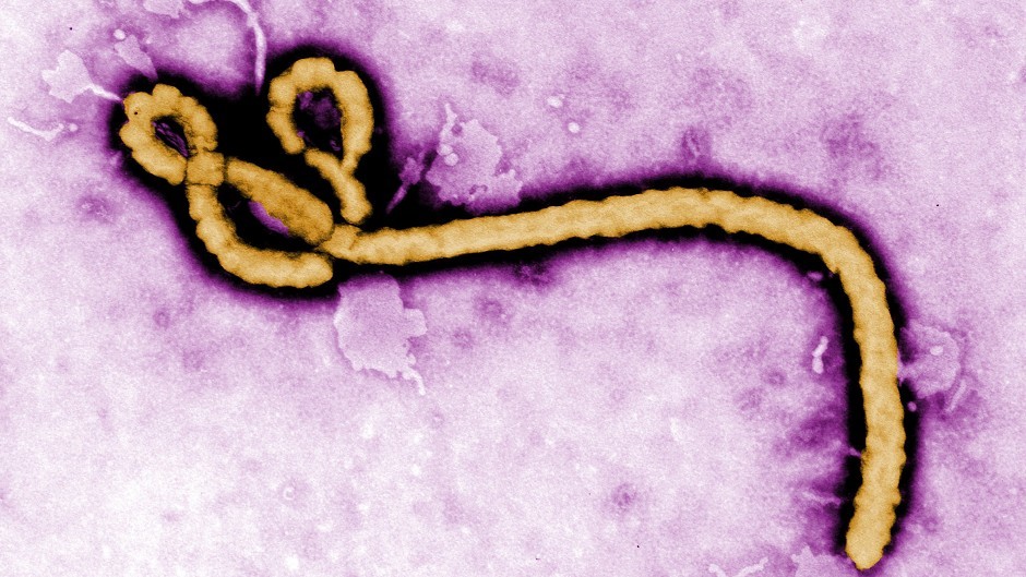 Ebola strain under the microscope