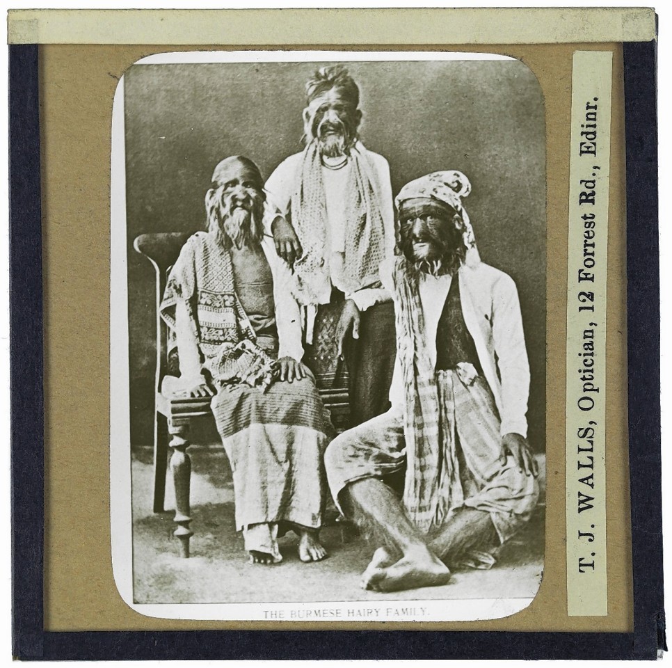  Burmese Hairy Family. Photograph of a Burmese family of three, mother, father and son, who have Hypertrichosis in the late 19th or early 20th century.