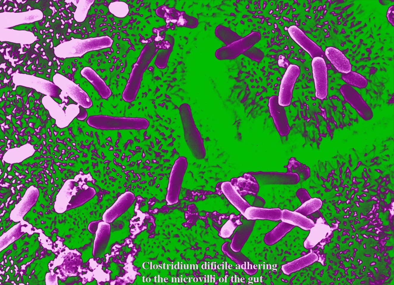 Clostridium difficile