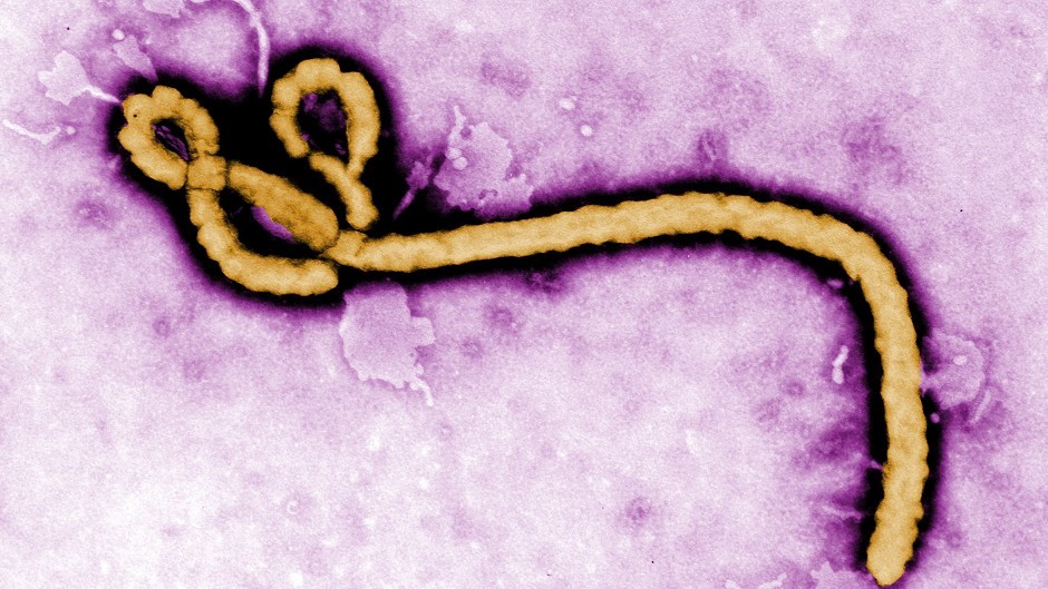 A woman is being tested in Edinburgh for Ebola
