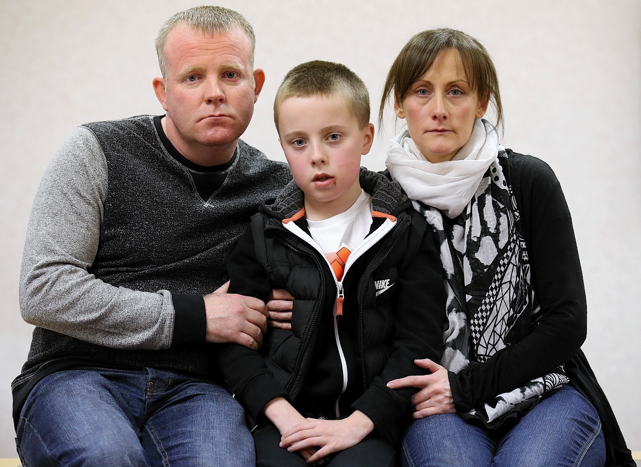 Kieran Duffy was left with two missing teeth and a hairline fracture to his face 