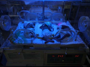 Three babies in one incubator