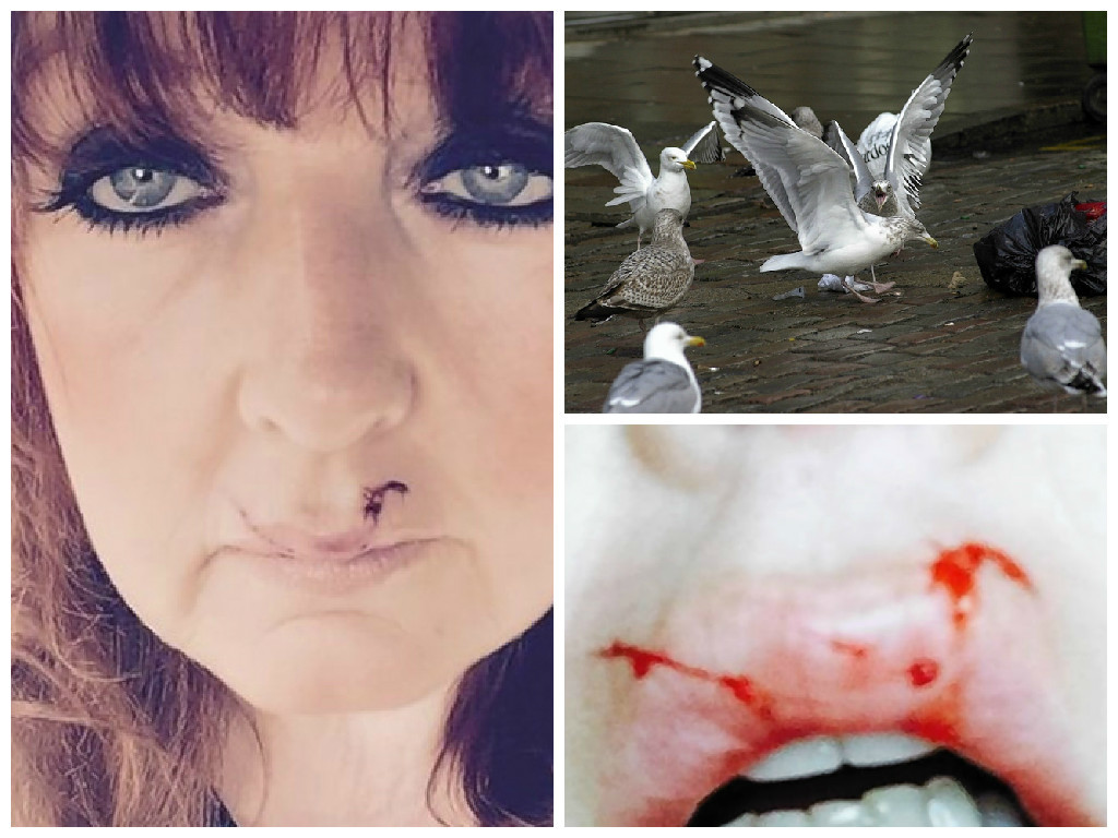 Jean Middleton, Buckie, who was walking her King Charles spaniel, Jackson, when she was attacked by a gull which cut her top lip