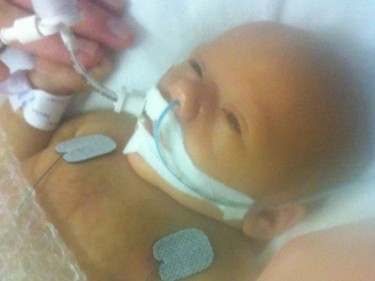 Emily, three days old, in neonatal at Yorkhill Hospital,