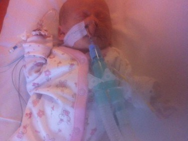 Emily recovering from her first heart surgery, wearing clothes for the first time at 6 and a half months old