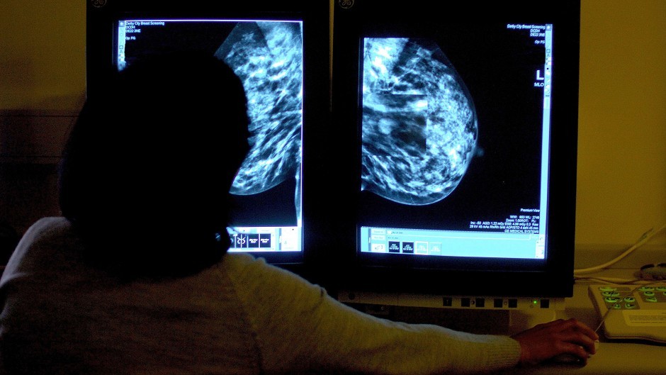 Breast cancer screening