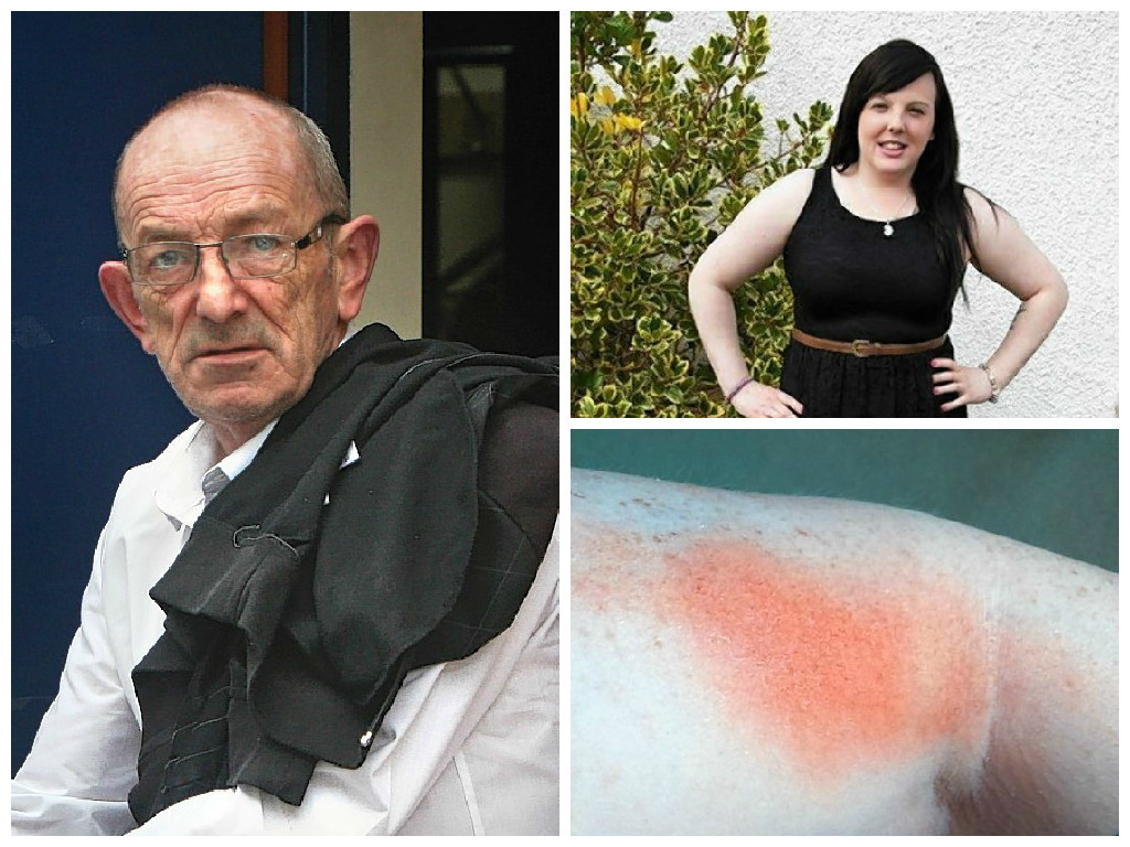 Lesley Jamieson was attacked by Sinclair Ross