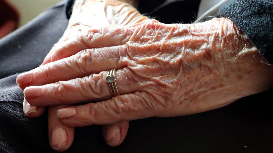 Dementia affects 850,000 people in the UK