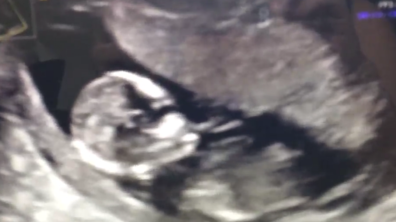Sandi Thom's pregnancy scan