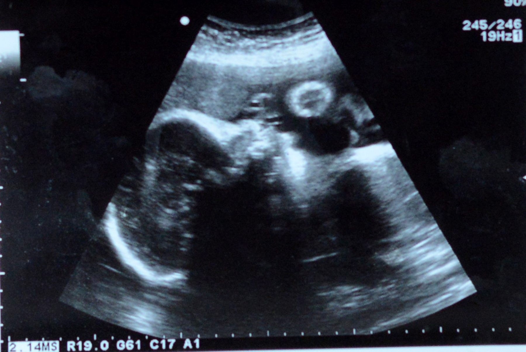 Baby scan photo