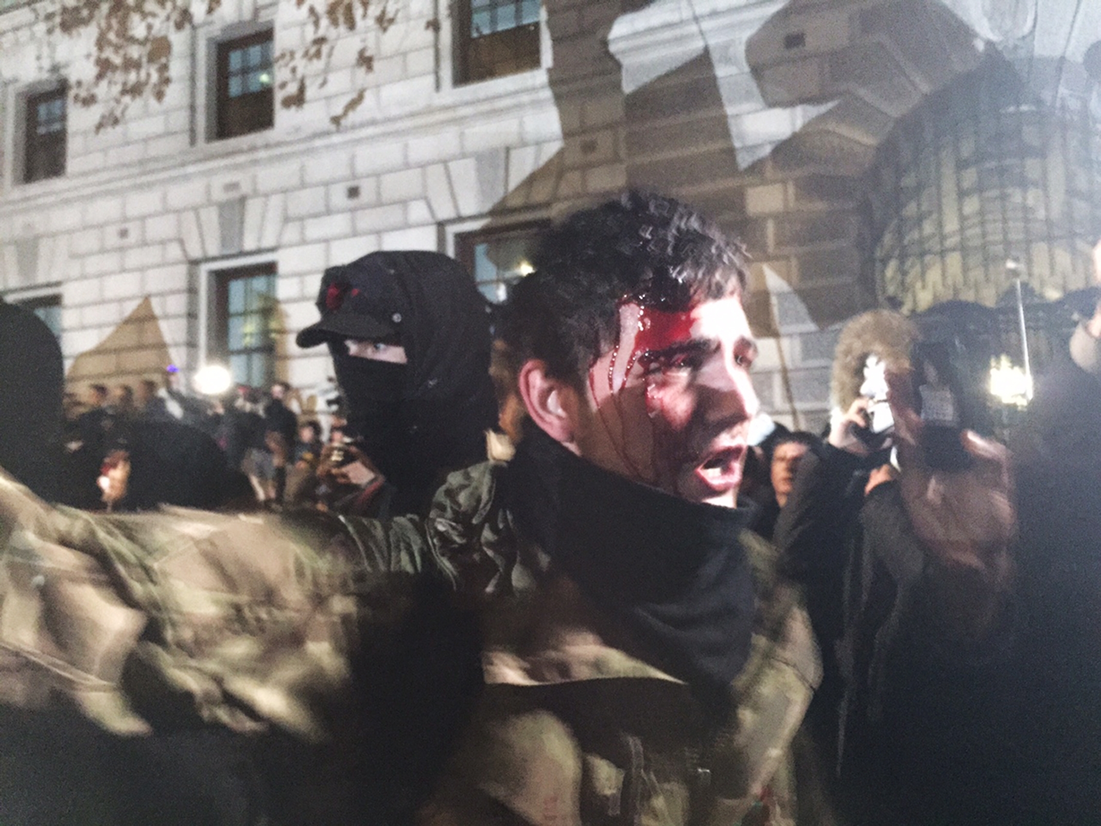 A protester with a bloodied head 