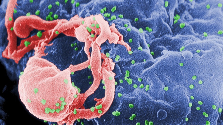 The HIV virus