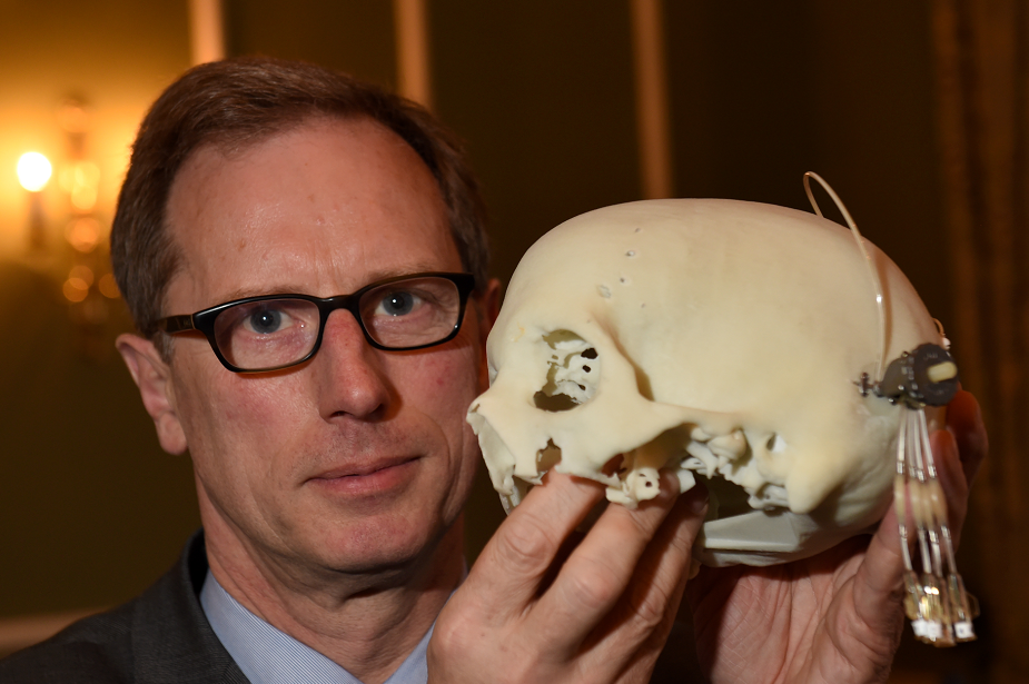 Professor Steven Gill displaying specialised skull-drilling technology