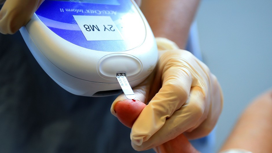 The research will seek to find out what causes diabetes