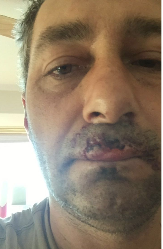 48-year-old Iain Wood was attacked at a local park in Banchory