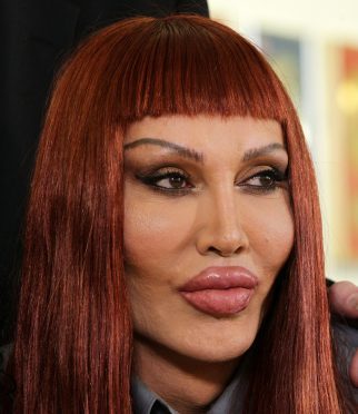 Pete Burns who has died at the age of 57.