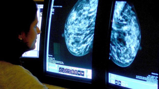 A consultant analysing a mammogram.