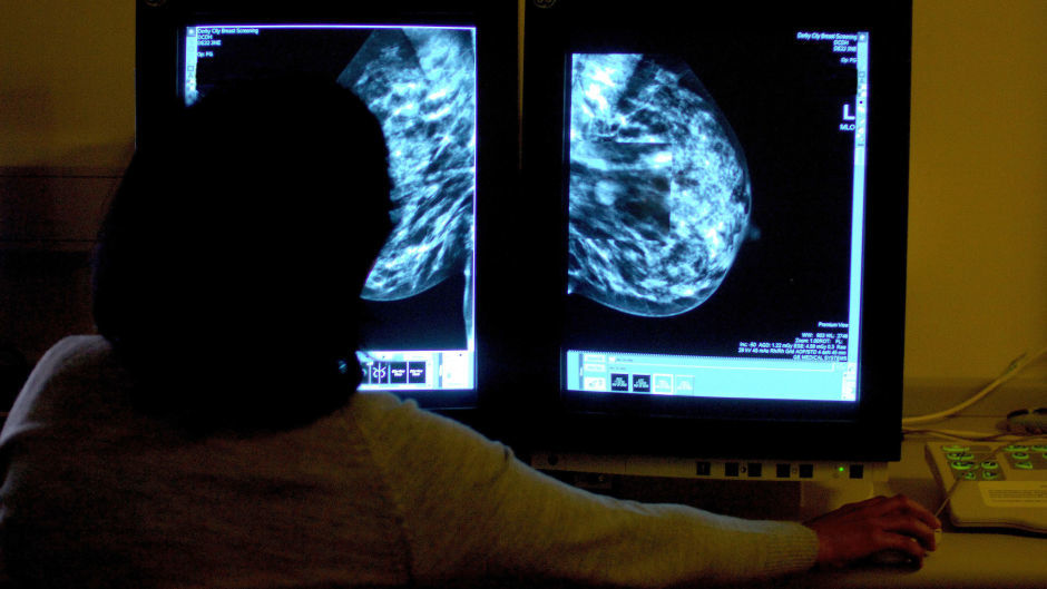 The mobile breast screening service is coming to Alford.