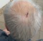 The pensioner was left with a three-inch cut on his head.