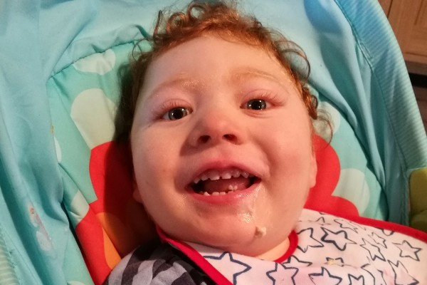More than 150 runners have joined forces to raise funds to help two-year-old Inverness boy Sam Douglas walk for the first time.