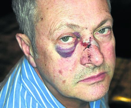 Chef Nick Nairn was attacked on Union Street  walking home from his cook school. Picture by Kami Thomson