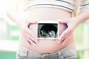 The local NHS service vowed to reconsider the policy last summer after it was revealed that no other health board levied a flat fee to expectant mothers for copies of scanned thermal images