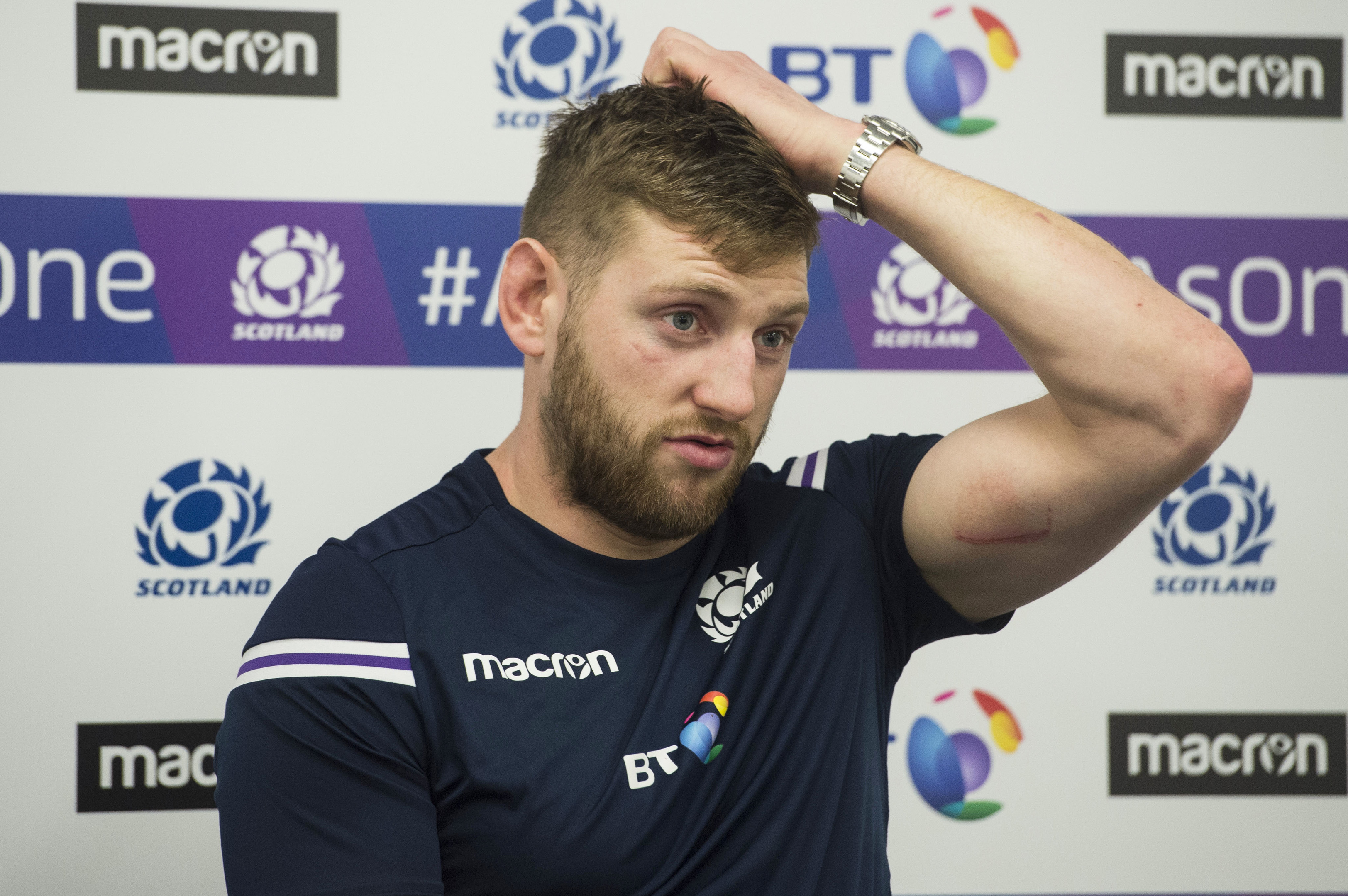 Scotland's Finn Russell has missed out on the first two Six Nations games.