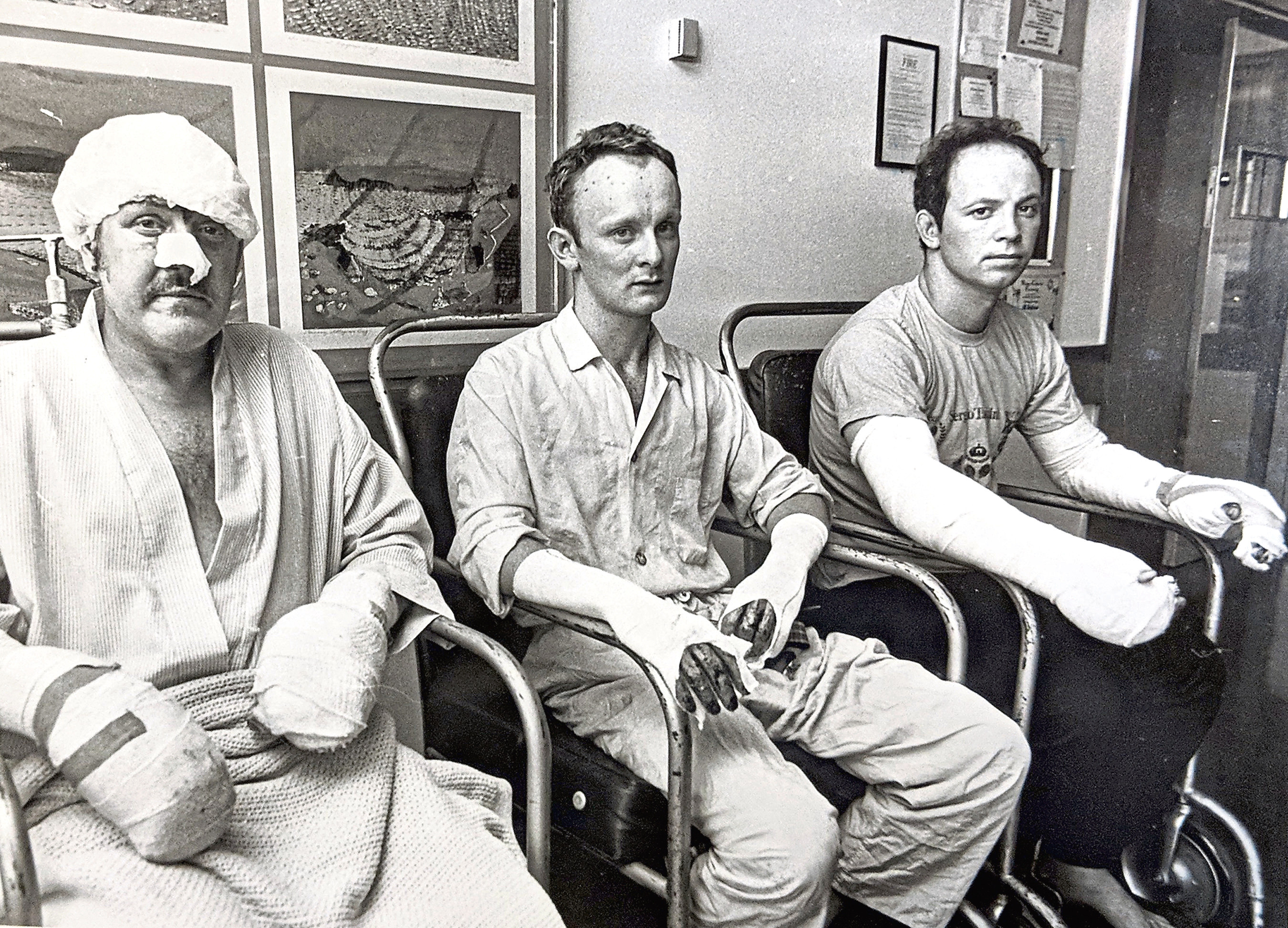 Piper Alpha survivors, including Mark Archibald Reid (centre), being treated for their injuries at ARI's burns unit.