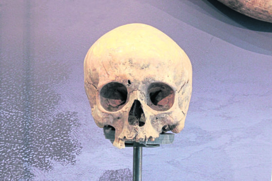 The skull from the personal collection of Sir Walter Scott is to be scientifically analysed.